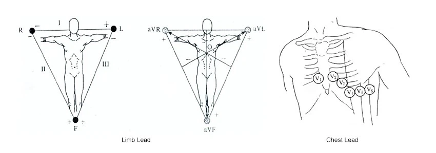 This is a description of limb leads and chest leads This is a description of limb leads and chest leads